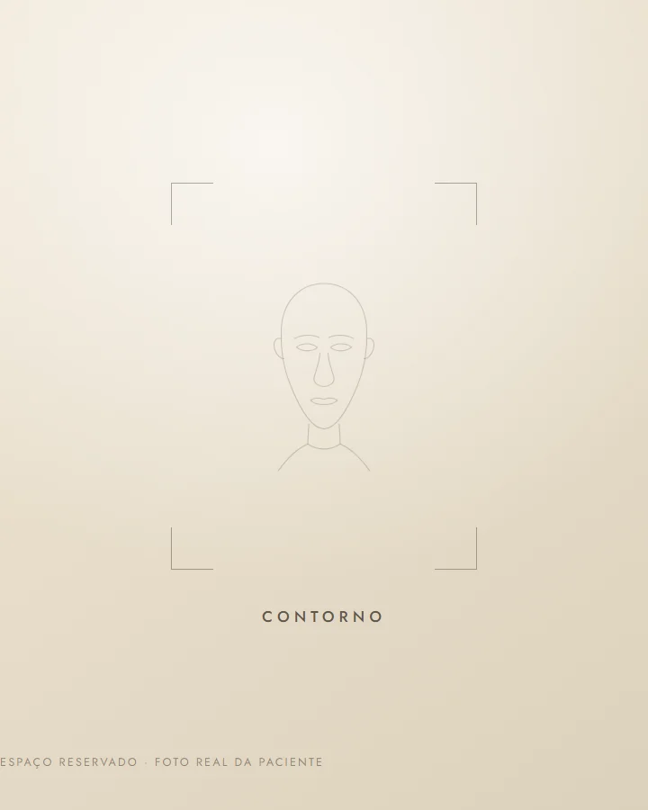 Contorno — depois (exemplo ilustrativo)