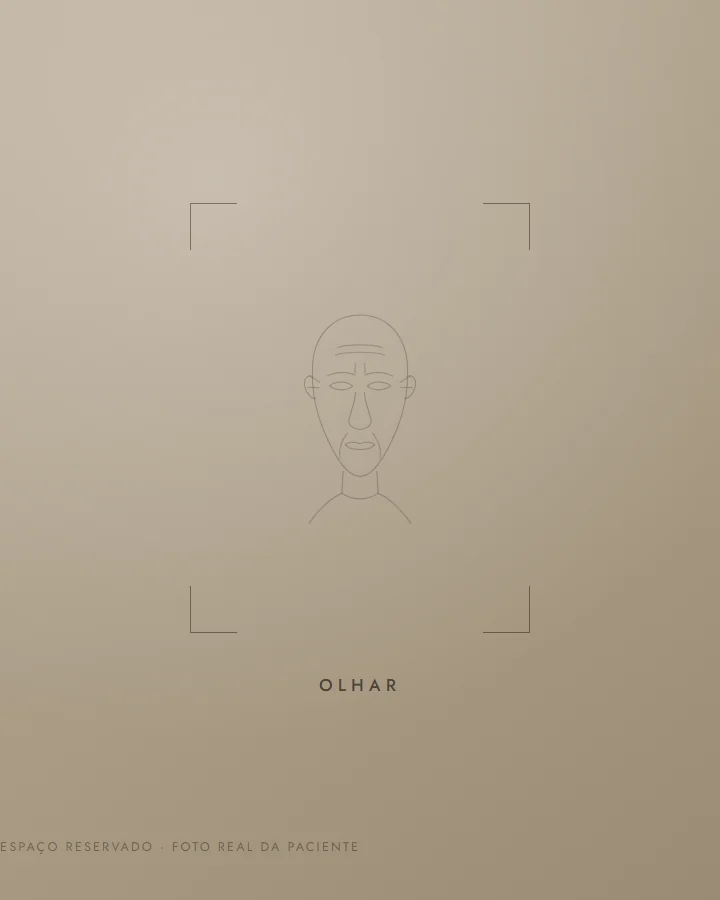 Olhar — antes (exemplo ilustrativo)