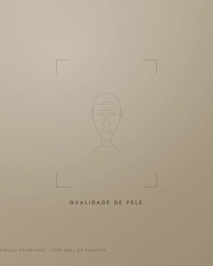 Qualidade de pele — antes (exemplo ilustrativo)
