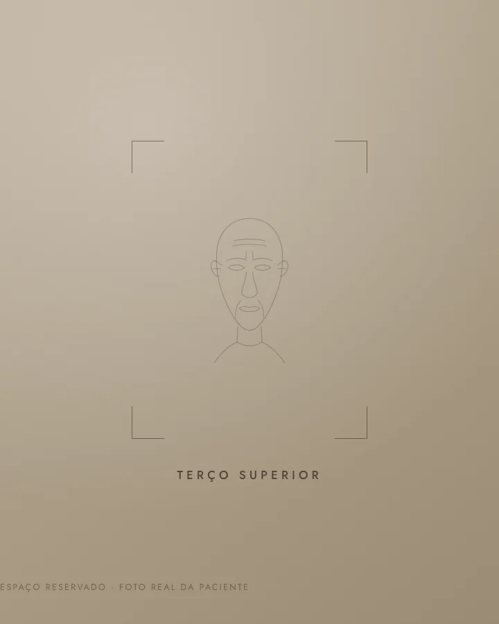 Terço superior — antes (exemplo ilustrativo)