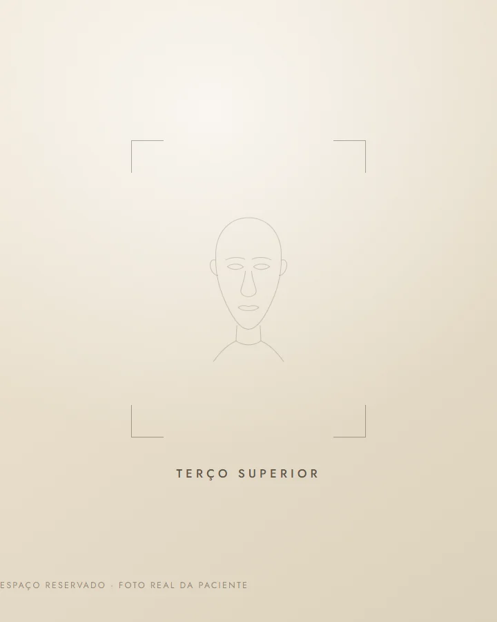 Terço superior — depois (exemplo ilustrativo)
